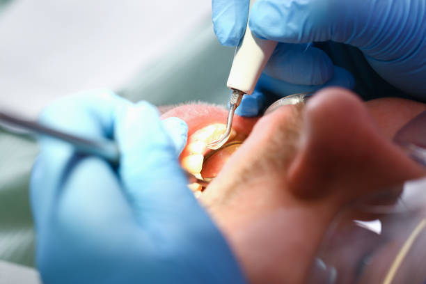 Best Emergency Gum Treatment in Red Oaks Mill, NY